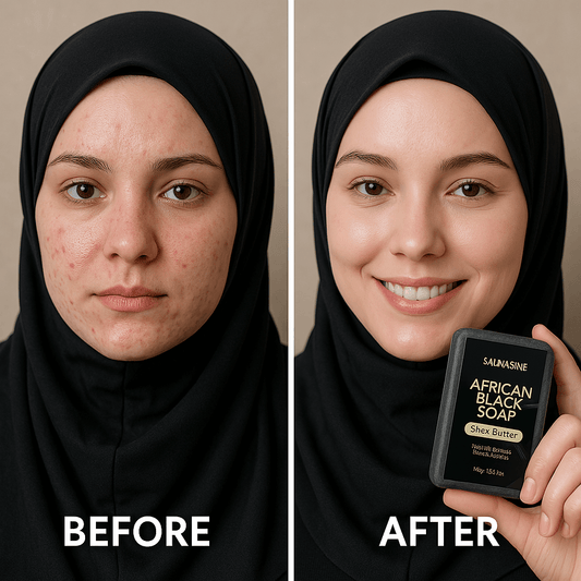 Comparison of skincare results using African Black Soap, showing before and after effects on skin clarity and texture.
